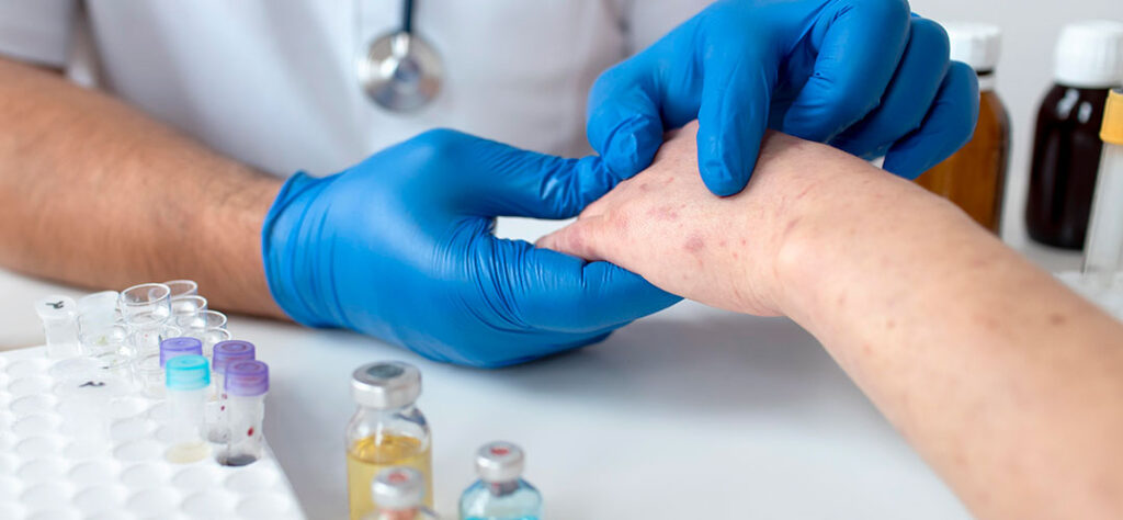 Allergies Treatment